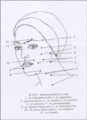 Miolifting - sema motornih tacaka Miolifting - sema motornih tacaka