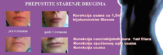 korekcija usana korekcija usana