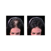 DERMA HAIR Fiberi za kosu 22gr (75 aplikacija)
