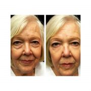 Instantly ageless mikrokrema2 Instantly ageless mikrokrema