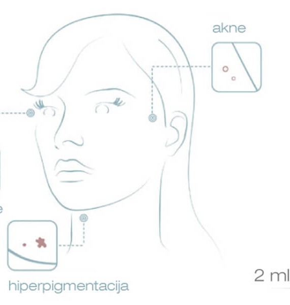 IBCN GLIKOLNA KISELINA (GLYCOLIC ACID 1%)